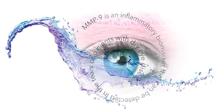 InflammaSécheresse-oculaire du site web